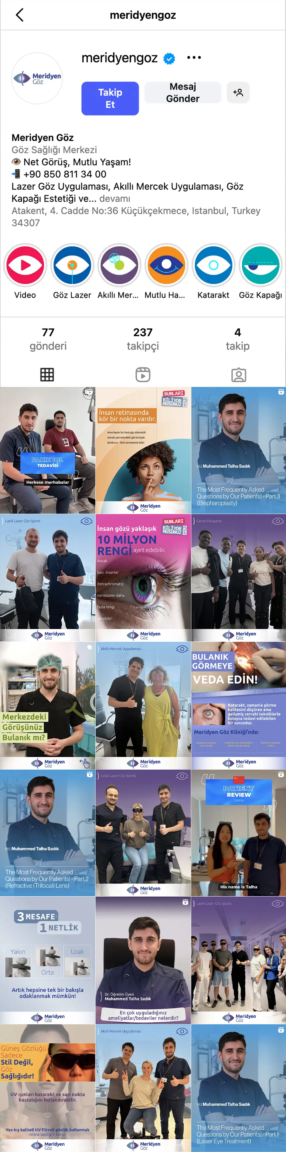 Meridyen Göz Instagram